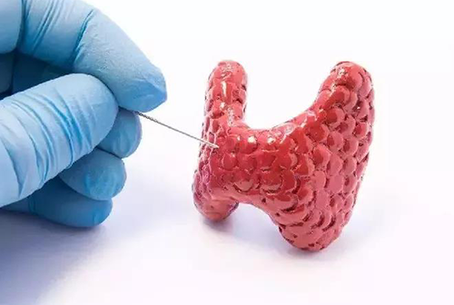 甲状腺疾病，包括甲状腺功能减退和甲状腺功能亢进，自古以来就是反复被医学研究人员研究的疾病